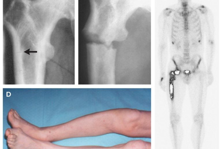 1732113184.245419_225024_image