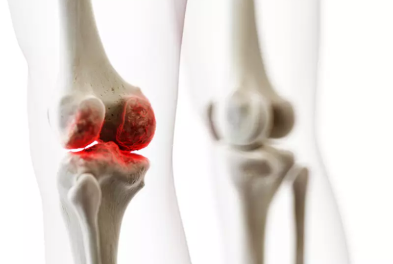 1732113245.702898_419969_image