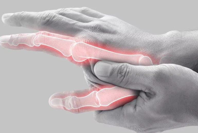 1732113266.336192_143722_image